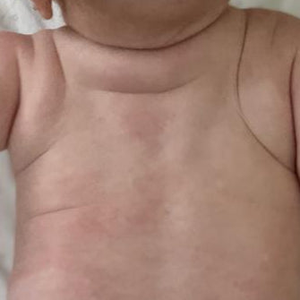 Baby smooth skin wearing a diaper with cloud design on a white background