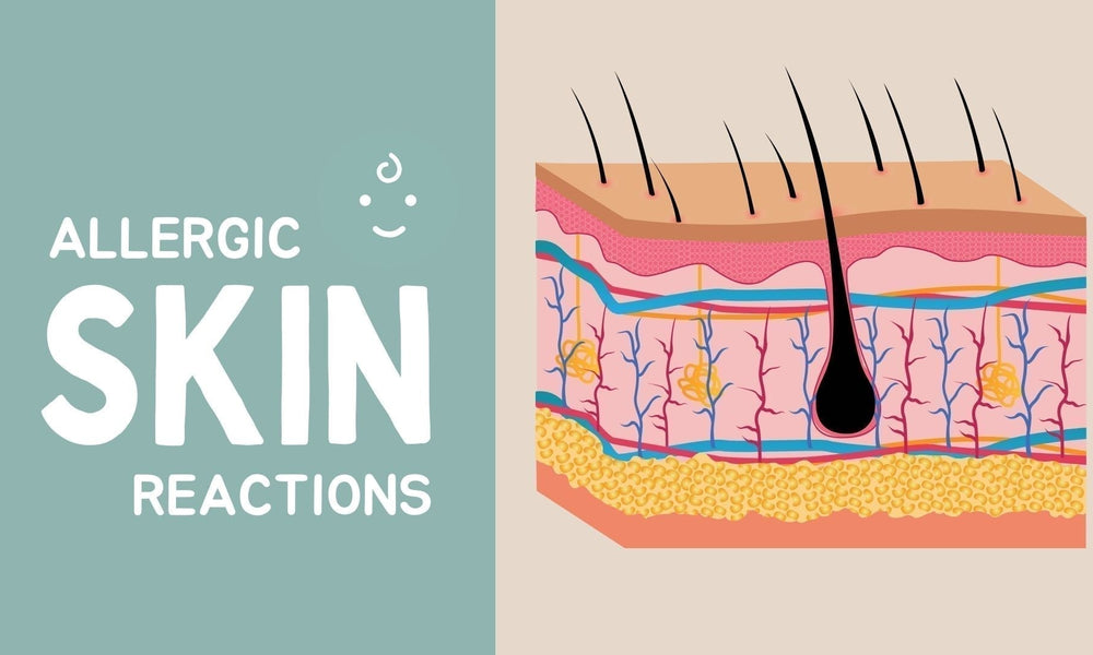 How to Identify Skin Allergy in Children? Signs and Easy Tips for Home Remedy