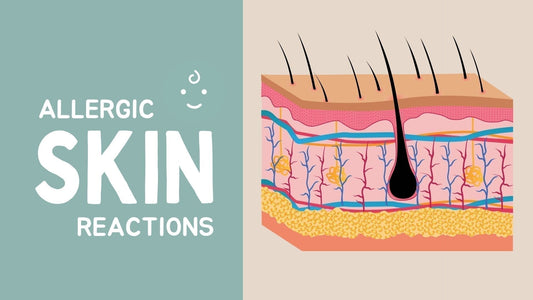 How to Identify Skin Allergy in Children? Signs and Easy Tips for Home Remedy