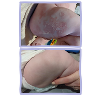 Eczema-Friendly Unisex Baby Leggings